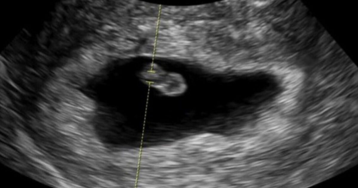 Actor-Idol Couple Announces Pregnancy Following Previous Miscarriage缩略图