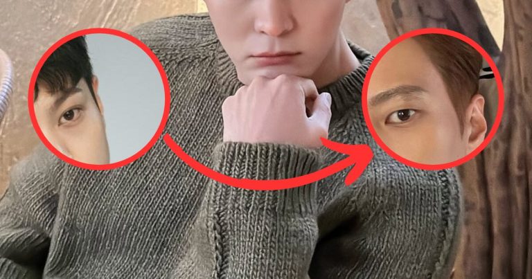 Top Actor “Cancelled” His Plastic Surgery And Returned Back To His Youthful Looks缩略图