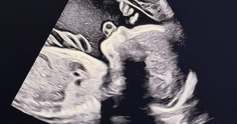 Idol-Turned-Actor Expecting First Child After Sudden Retirement And Departure From Korea缩略图