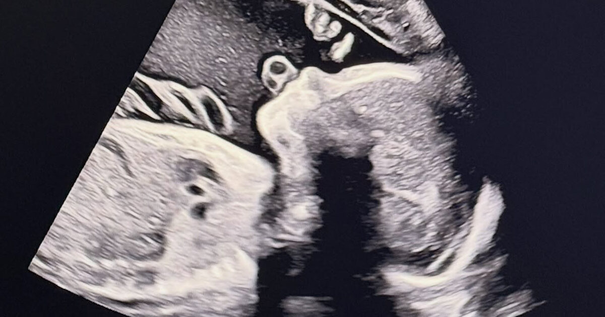 Idol-Turned-Actor Expecting First Child After Sudden Retirement And Departure From Korea缩略图