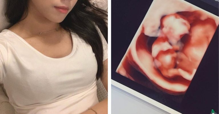 3rd Gen Idol Makes Viral Pregnancy Announcement缩略图