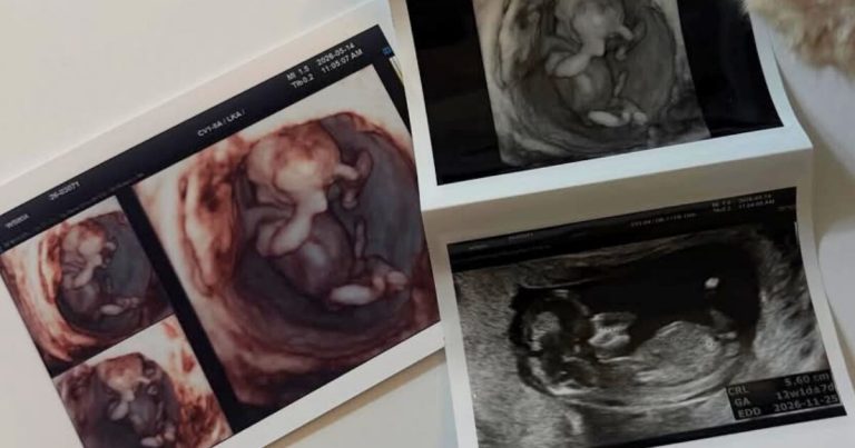 21-Year-Old Active Musician Announces Premarital Pregnancy缩略图