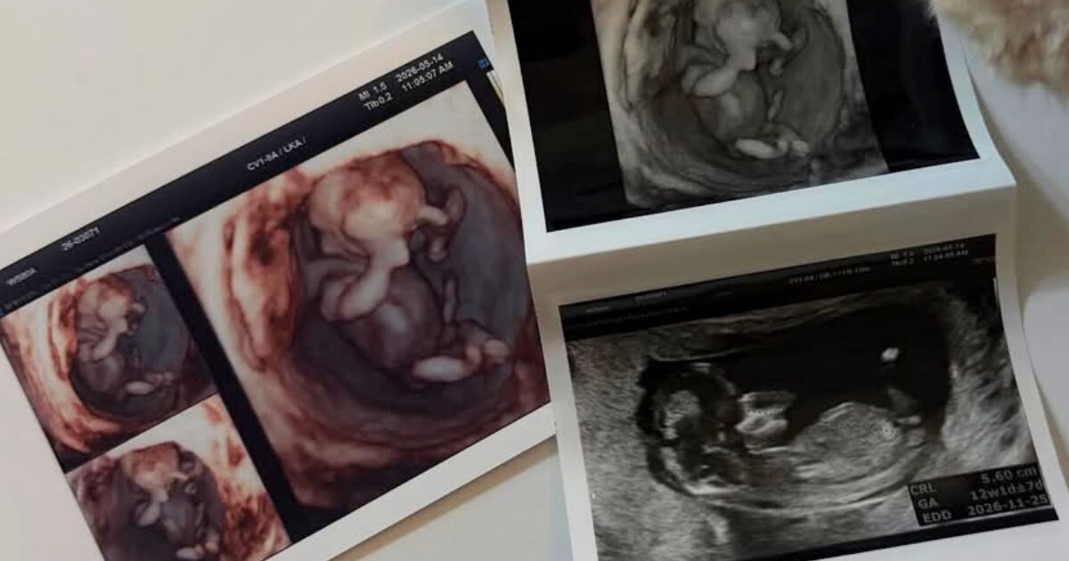 21-Year-Old Active Musician Announces Premarital Pregnancy缩略图