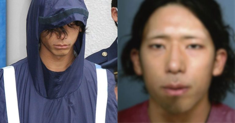 The Hideous Reason A Man Resorted To Performing Plastic Surgery On Himself缩略图