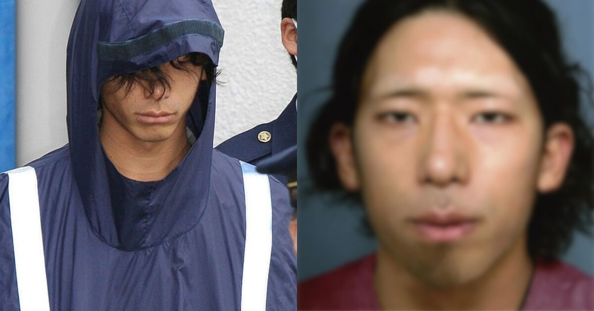 The Hideous Reason A Man Resorted To Performing Plastic Surgery On Himself缩略图