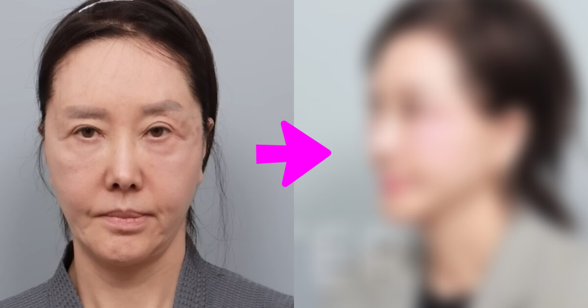 61-Year-Old Actress Shocks With New Face After Cosmetic Procedures缩略图