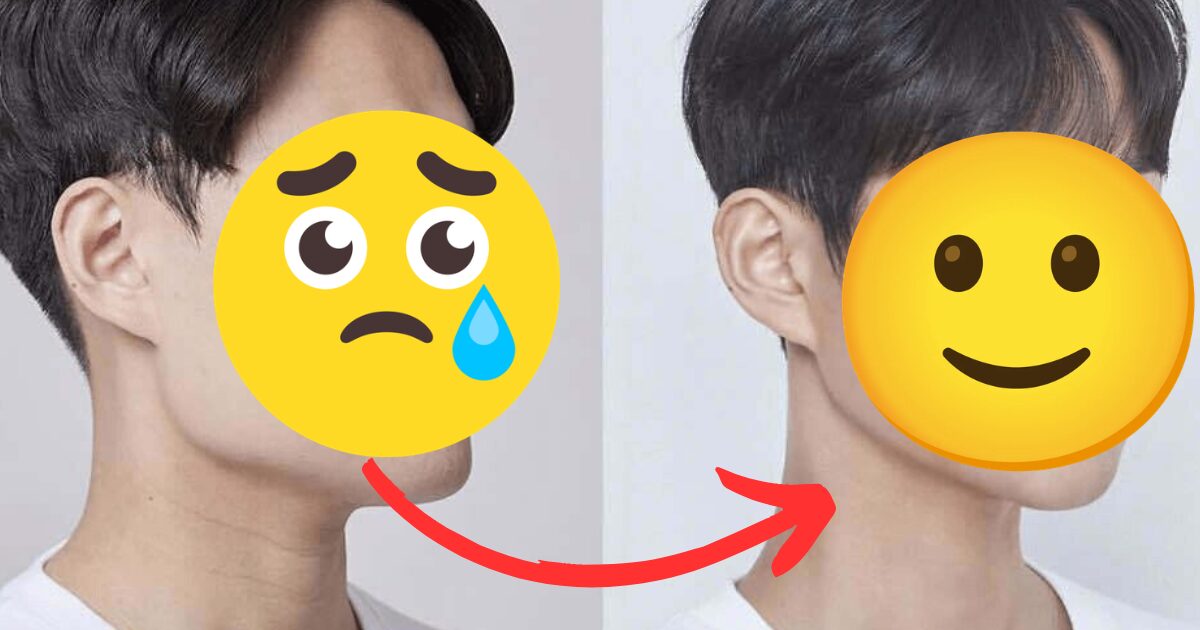 From “Spongebob” To Idol-Esque — The Korean Bus Driver Who Transformed His Visuals With Plastic Surgery缩略图