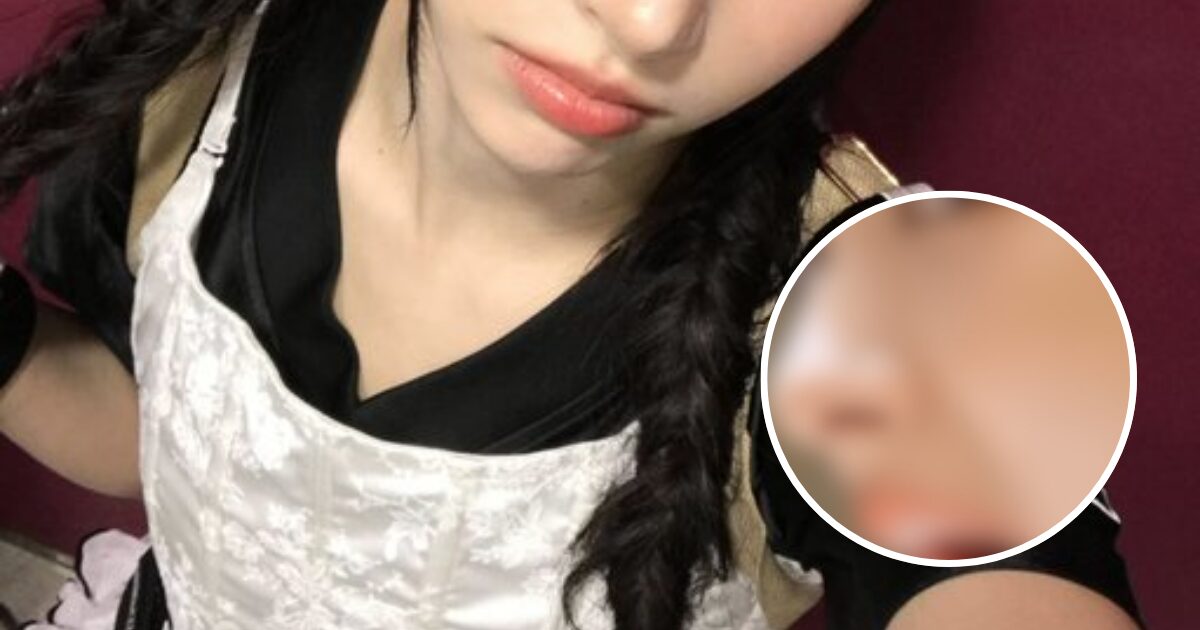 Popular Female HYBE Idol Hit With Plastic Surgery Allegations — Sparks Heated Debate缩略图