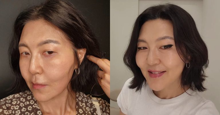 Korean Celeb Shocks With Changed Appearance After Cosmetic Procedure缩略图