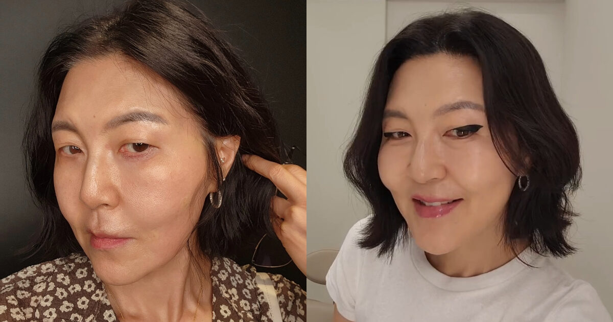 Korean Celeb Shocks With Changed Appearance After Cosmetic Procedure缩略图