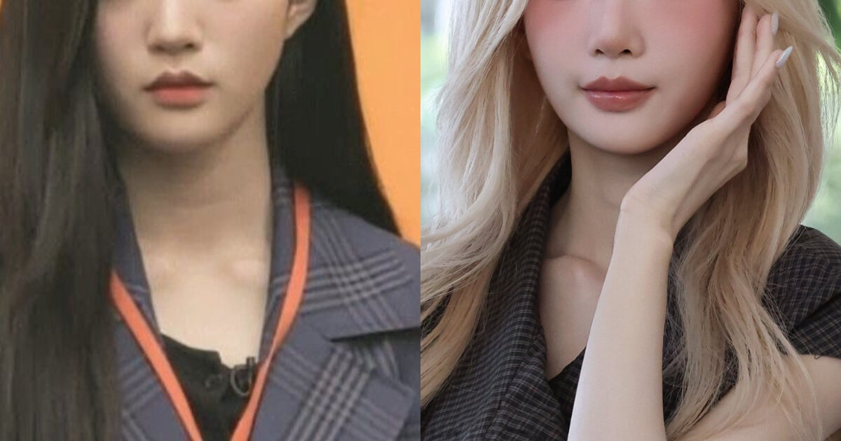 Popular Female Idol Looks Totally Unrecognizable, Sparks Plastic Surgery Rumors缩略图