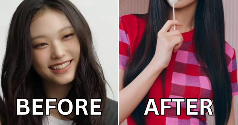 NewJeans’ Haerin Suspected Of Having Controversial Cosmetic Procedure缩略图