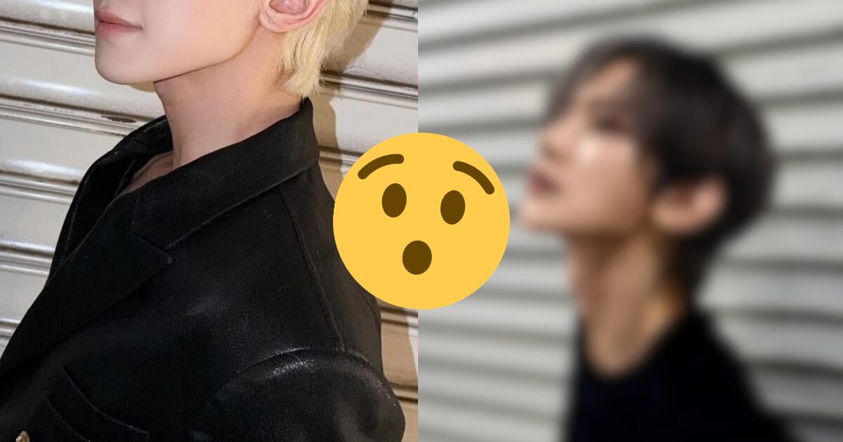 Popular 4th Gen Idol Hit With Cosmetic Procedure Allegations, Triggering Debate缩略图