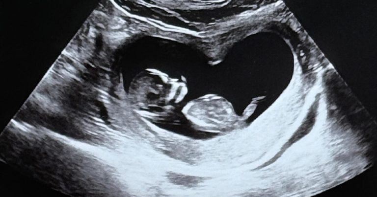 Korean Star Couple Surprises With Pregnancy News缩略图