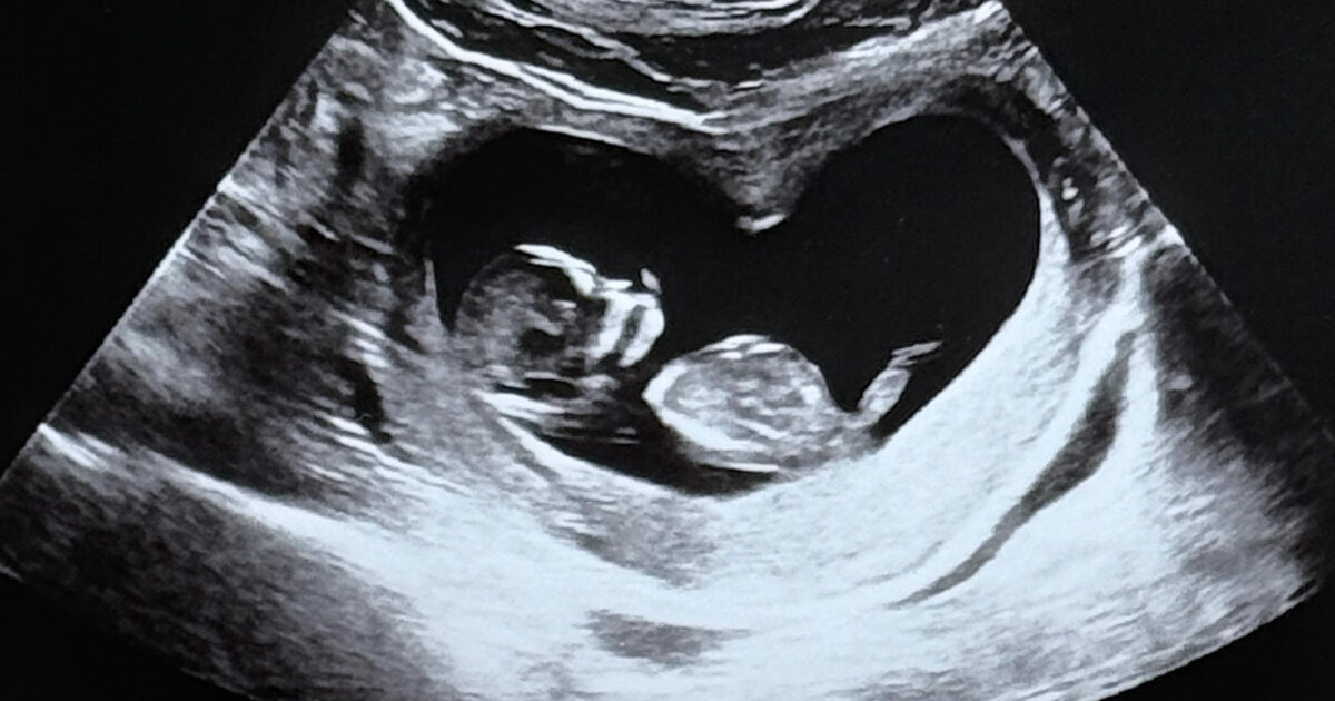 Korean Star Couple Surprises With Pregnancy News缩略图