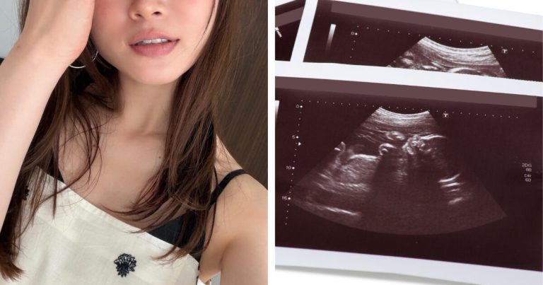 Popular Idol Announces Pregnancy And Upcoming Hiatus With No Mention Of A Partner缩略图