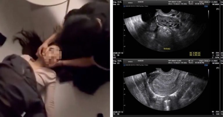 Netflix Actor’s Alleged Ex-Girlfriend Shares Startling Proof Of His Abusive Behavior + Forced Abortion缩略图