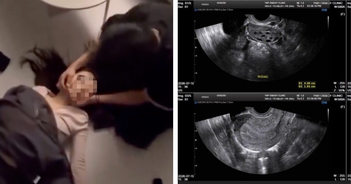 Netflix Actor’s Alleged Ex-Girlfriend Shares Startling Proof Of His Abusive Behavior + Forced Abortion缩略图