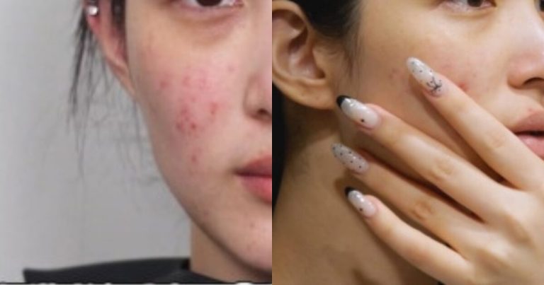 3rd Gen Girl Group Member Reveals Shocking Bare Face缩略图