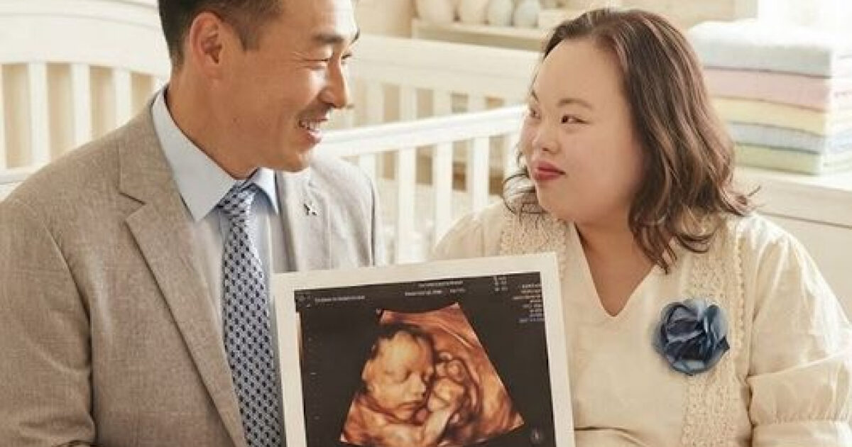 Famous Actress With Down Syndrome Shocks With Ultrasound Image缩略图