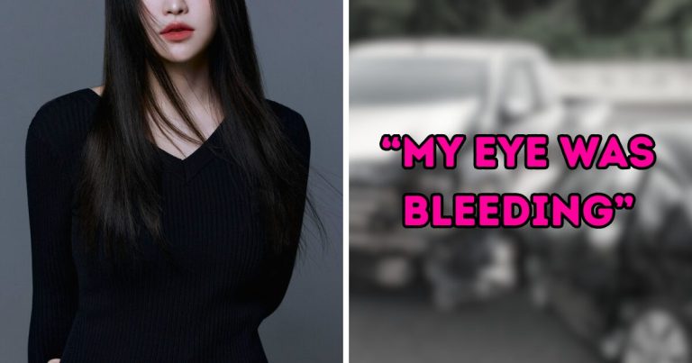 Red Velvet Star Exposes Horrific Car Accident SM Entertainment Kept Secret For 10 Years缩略图