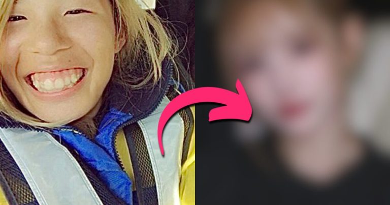 Woman Spends A Fortune On 25 Plastic Surgeries To Turn Into A Model Face缩略图