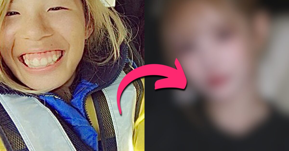 Woman Spends A Fortune On 25 Plastic Surgeries To Turn Into A Model Face缩略图