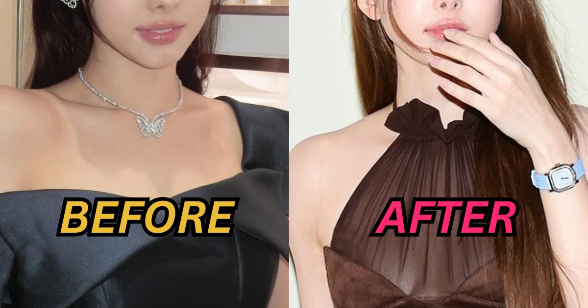 Top Girl Group Idol Catches Plastic Surgery Accusations After Recent Public Appearance缩略图