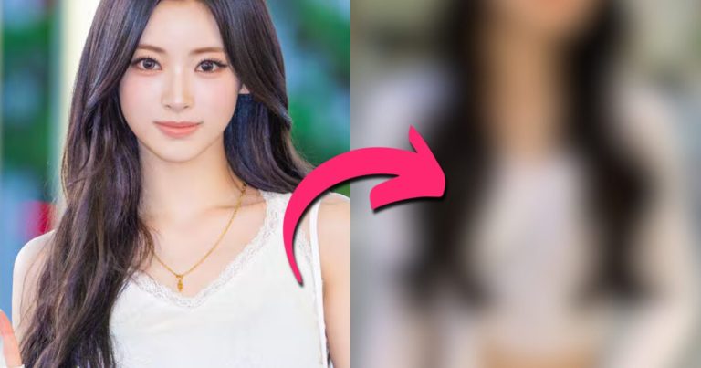 MEOVV’s Anna Catches Plastic Surgery Allegations缩略图